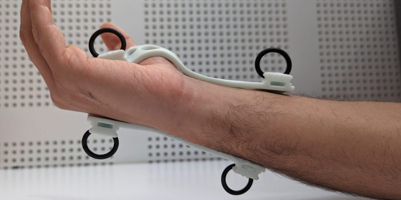 Side view of arm with splint on